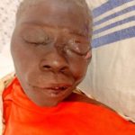 Woman Fights Death