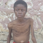 12-Year-Old Battles Mysterious Illness